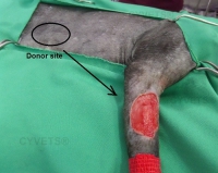 Full Thickness Skin Graft